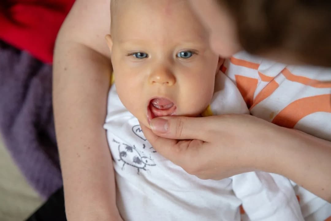 Ząbkowanie: Jak wyglądają dziąsła? Objawy i ulga dla malucha