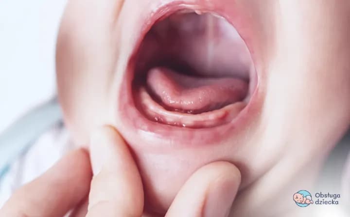Kiedy pierwsze zęby u niemowlaka? Objawy i ulga w bólu